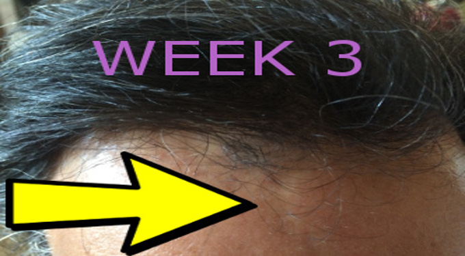 Hair growth