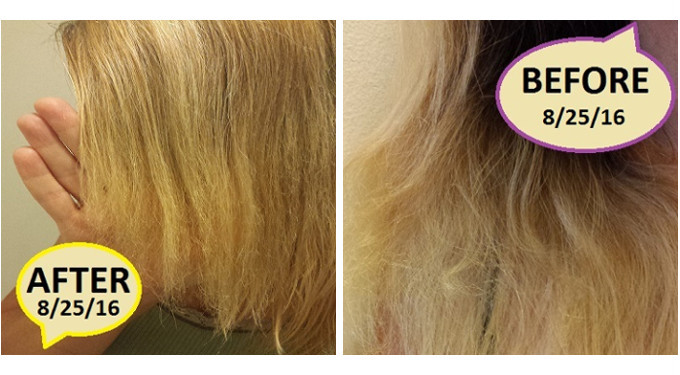 Before and After