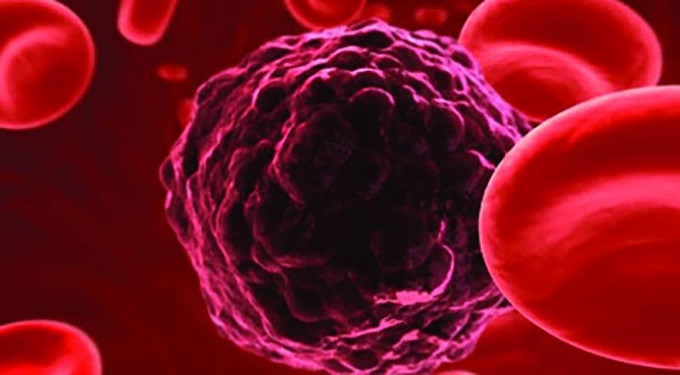 Laboratory Tests