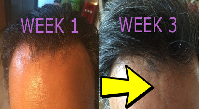 Week 1 and 3