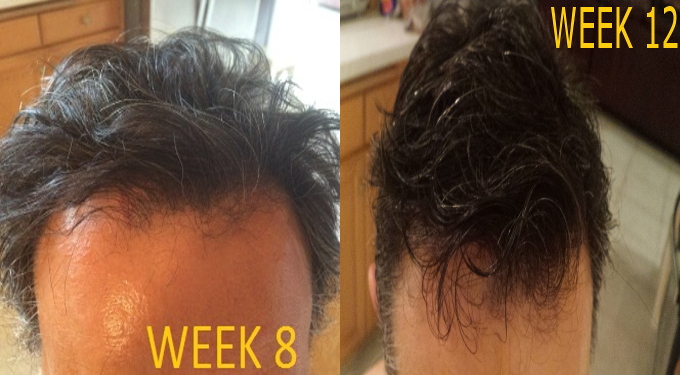 Week 8 and 12