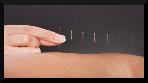 7 Absolute Ways To Cure Back Pain